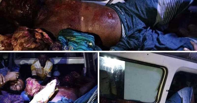 ভোলার লালমোহনে বোমা তৈরির সময় বিস্ফোরনে নিহত ১ আহত ২