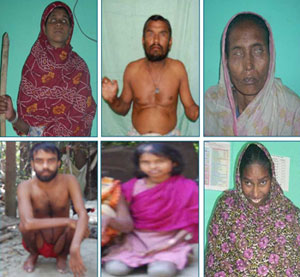 প্রতিবন্ধী