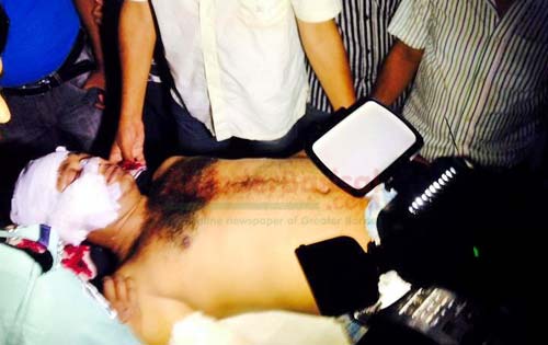 attack-on-pulak-chatarjee-injured-barisal-journalist বরিশাল প্রেসক্লাবের সাধারণ সম্পাদক পুলক চ্যাটার্জিকে কুপিয়ে জখম