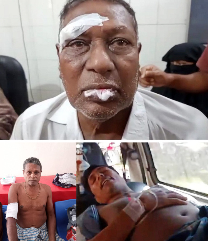 বাউফলে বাবা ও দুই ছেলেকে কুপিয়ে জখম