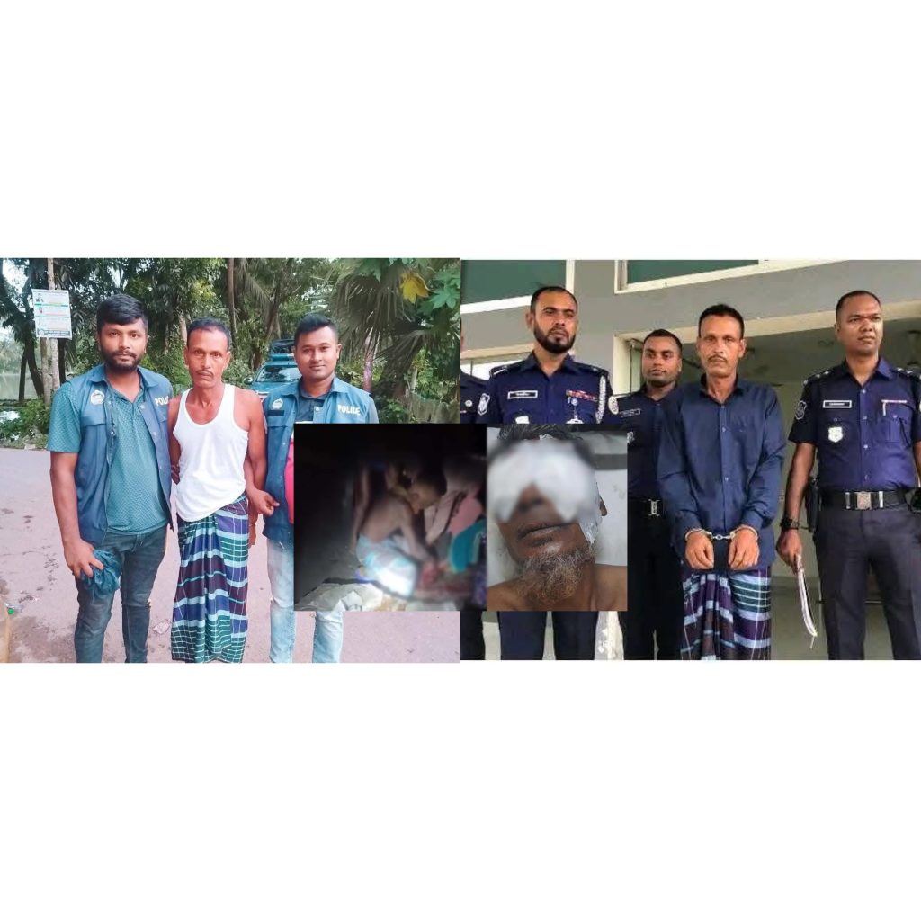 বরিশালে ভাইয়ের চোখ উঠিয়ে নেয়ার ঘটনায় অভিযুক্ত এক ভাই গ্রেপ্তার