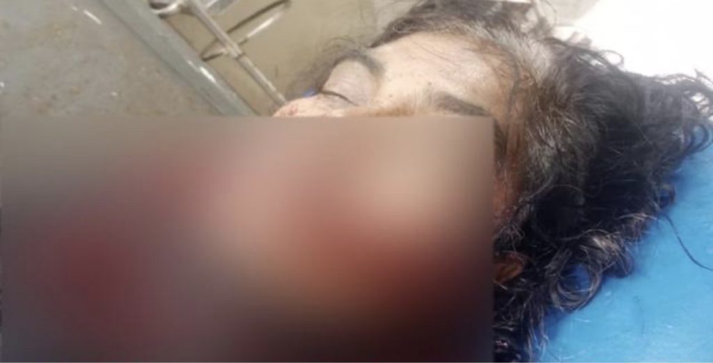 উজিরপুরে আল্লাহু আকবর বলে হ*ত্যার উদ্দেশ্যে আপন চাচিকে কু*পি*য়ে জ*খ*ম