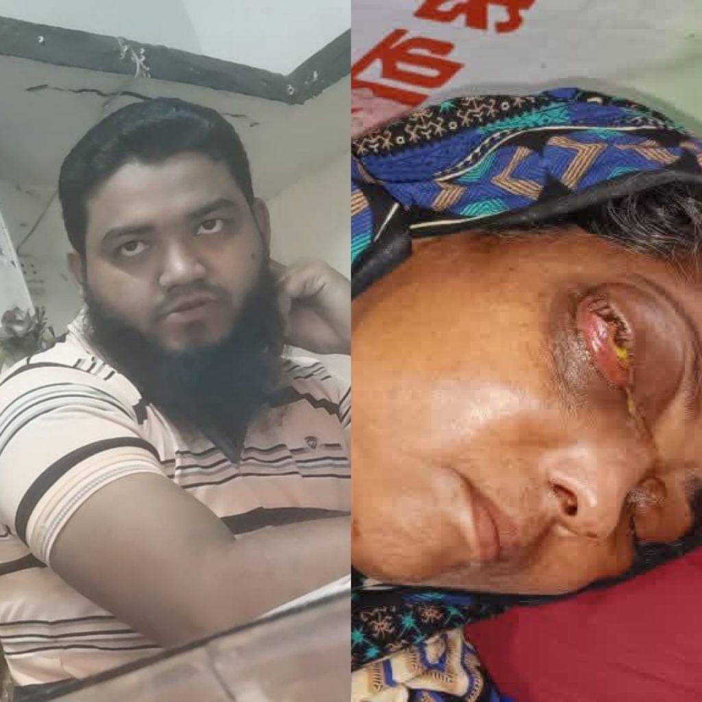 বাউফলে পল্লী চিকিৎসকের ভুল চিকিৎসায় মৃত্যু পথযাত্রী এক নারী