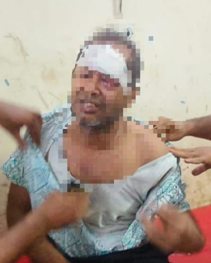 কলাপাড়ায় আইনজীবীকে কুপিয়ে হত্যা চেষ্টা ঘটনার ২৩ দিনেও গ্রফতার হয়নি কেউ কলাপাড়ায় আইনজীবীকে কুপিয়ে হত্যা চেষ্টা ঘটনার ২৩ দিনেও গ্রফতার হয়নি কেউ