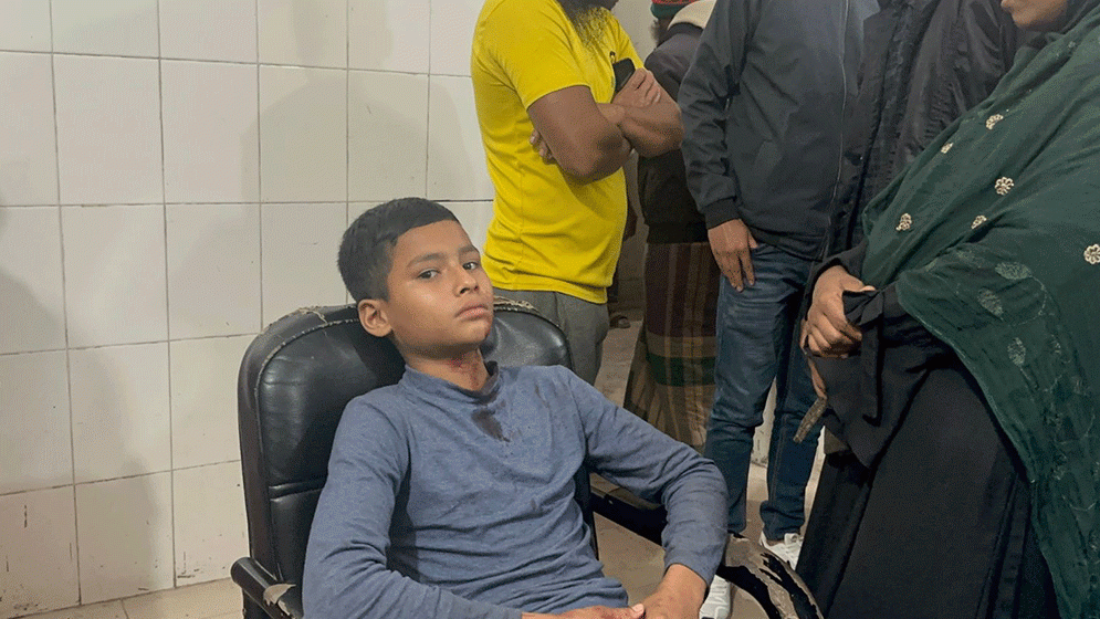 বাউফলে শিশু শ্রমিককে খুনতি দিয়ে পিটিয়ে জখম