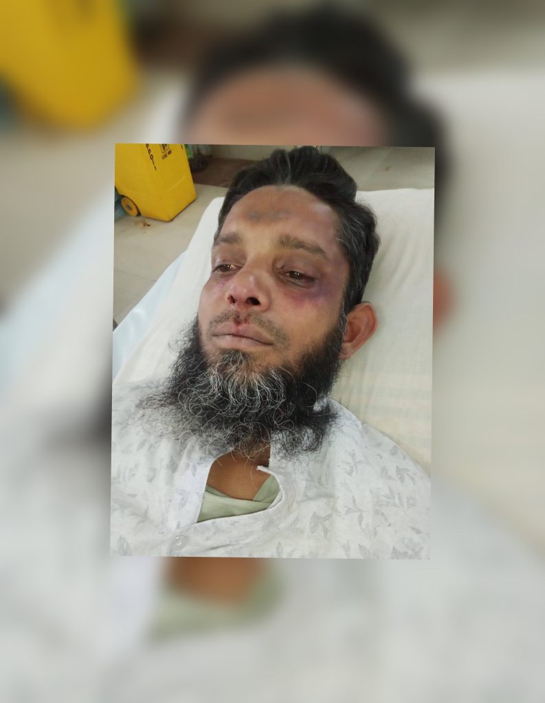 বরিশাল কাশিপুরে বিএনপি নেতার হামলায় জামায়াতকর্মী গুরুতর জ’খ’ম বরিশাল কাশিপুরে বিএনপি নেতার হামলায় জামায়াতকর্মী গুরুতর জ’খ’ম
