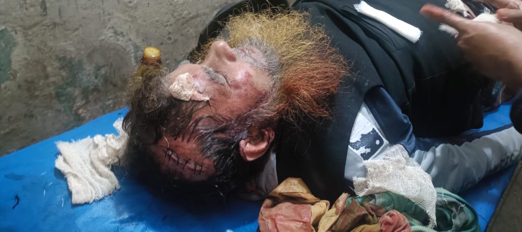 কাজিরহাটে বিএনপি কর্মীদের হামলায় ৬ জামায়াতকর্মী আহত, ১জন গুরুতর