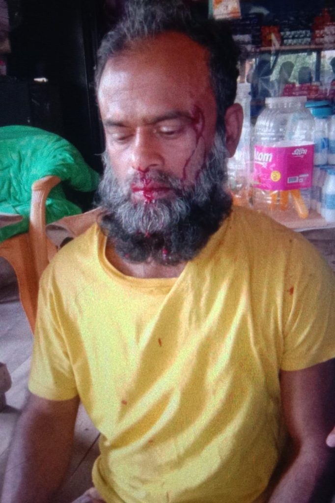 মির্জগঞ্জে বিএনপি নেতাকে মা*র*ধ*র, হাসপাতালে ভর্তি