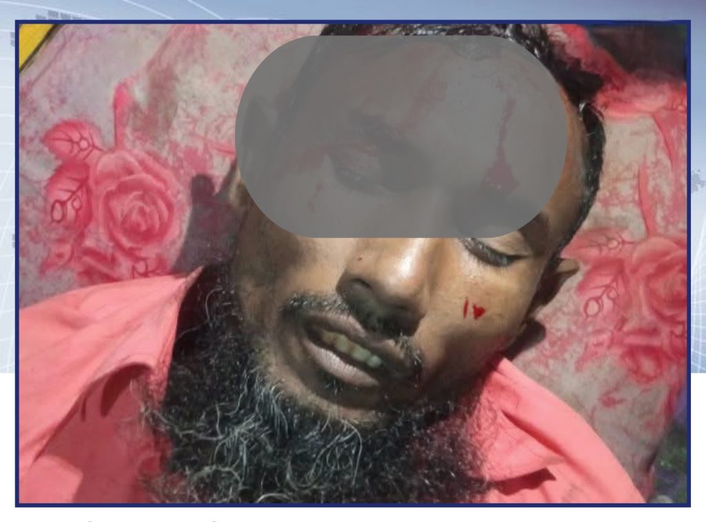 দশমিনায় ভাতিজার হামলায় চাচা গুরুতর আহত