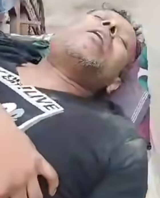 বানারীপাড়ায় যুবলীগ নেতাকে কুপিয়ে জখম, বিএনপির ১৪ নেতাকর্মীর বিরুদ্ধে মামলা