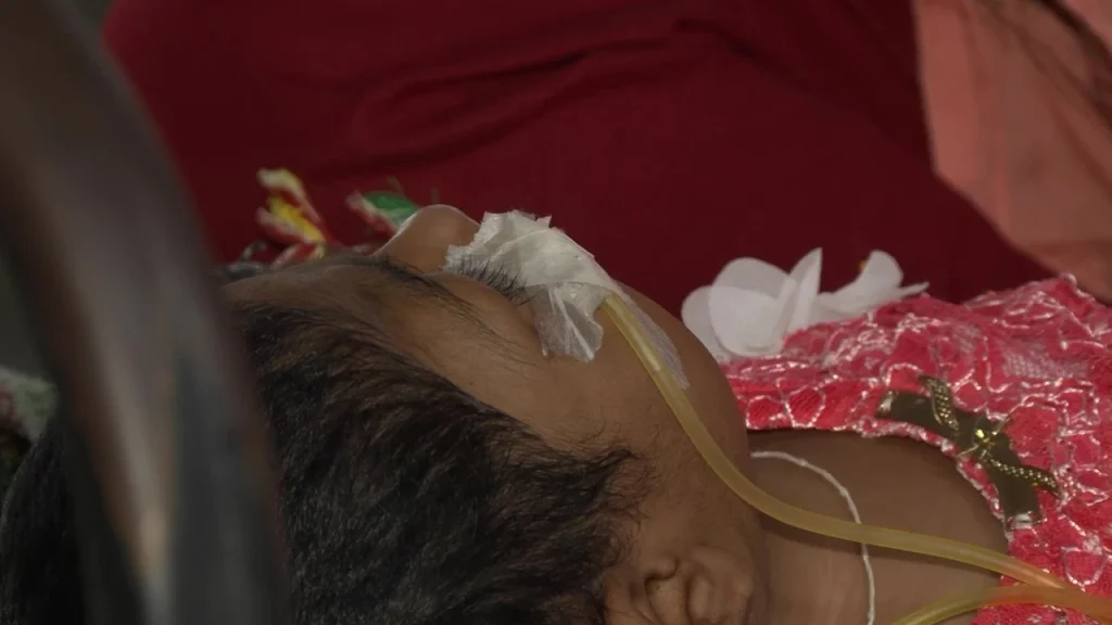 বরিশালে হামের উপসর্গ নিয়ে শিশুর মৃত্যু
