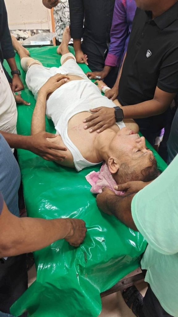 দুমকিতে সড়ক দুর্ঘটনায় অতিরিক্ত সচিব শামীমুজ্জামান ফিরোজ আহত