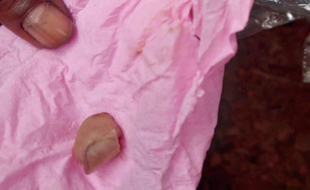 চুরি করতে এসে গৃহবধূর কামড়ে আঙুল হারাল চোর